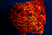 HIV: dois novos casos de cura são anunciados; total chega a 13